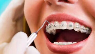 dental-orthodontics