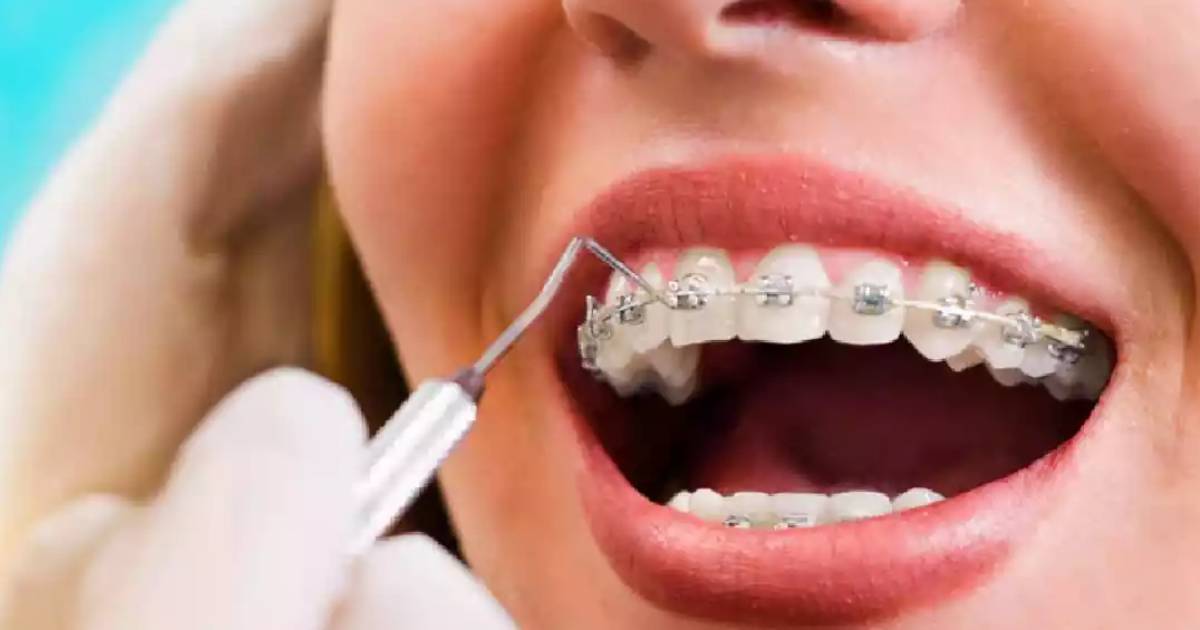 dental-orthodontics