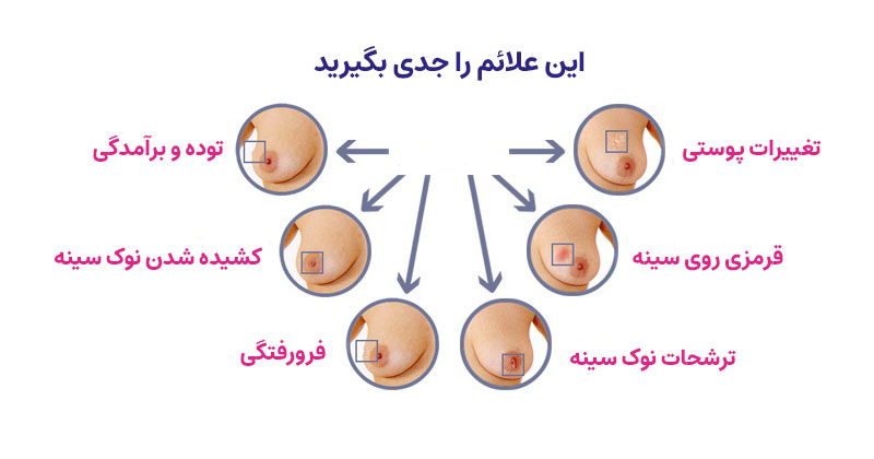 نشانه های سرطان سینه که باید جدی بگیرید